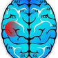 Dyslexia SMALL International- Auto Train Brain Software Subscription 3 Months autotrainbrainen