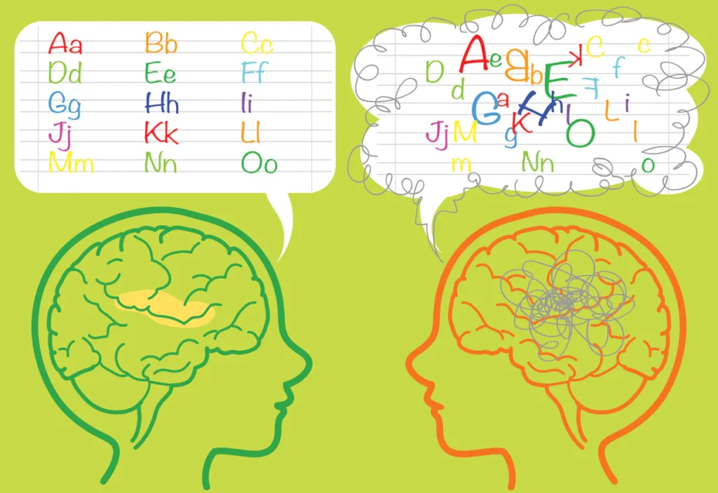 dyslexia-brain-image